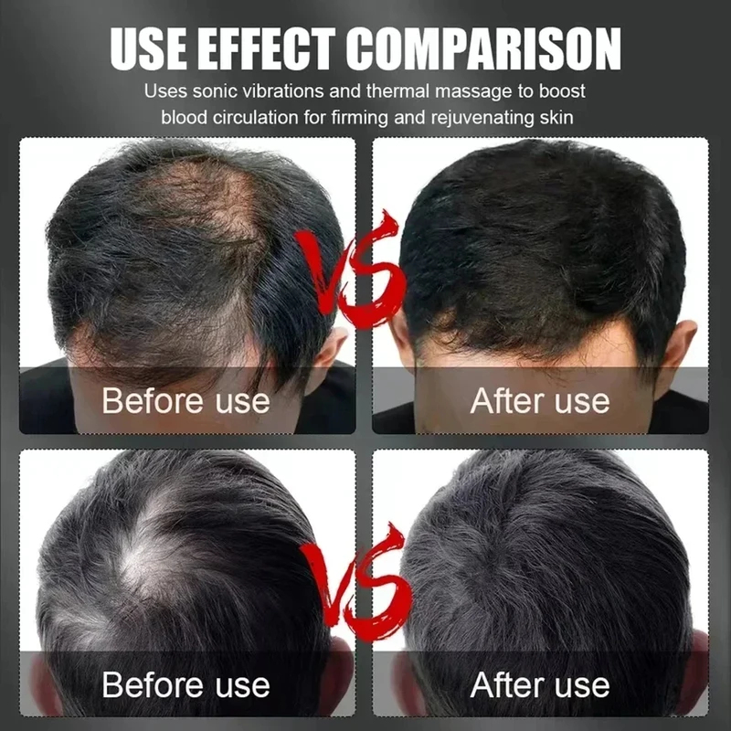 660nm 850nm Red Light Infrared - Hair Care ulasan dan harga